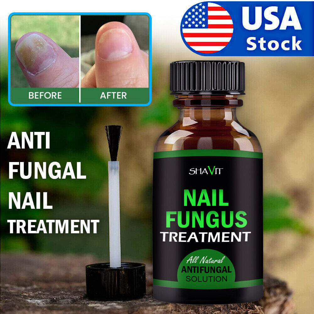 Fungi-Nail® Pen - Maximum Strength Fungi-Nail® Anti Fungal Products Fungi-Nail® Pen - Maximum Strength Fungi-Nail® Anti Fungal Products