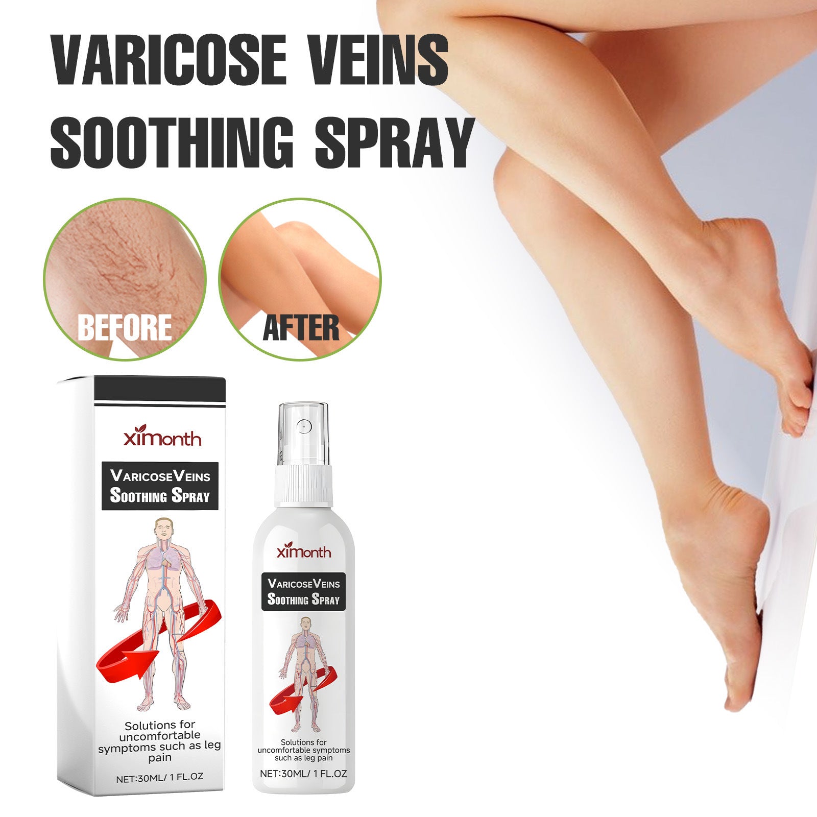 Intravenous Spray To Relieve Leg Muscle Soreness Care Spray