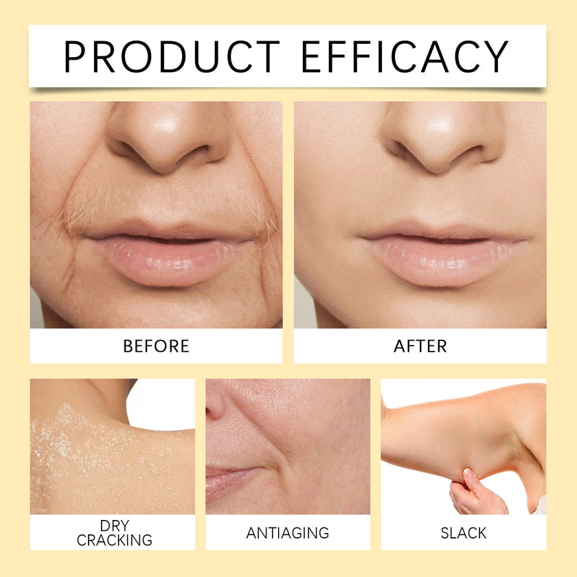 Body Skin Cream Moisturizing And Nourishing Face