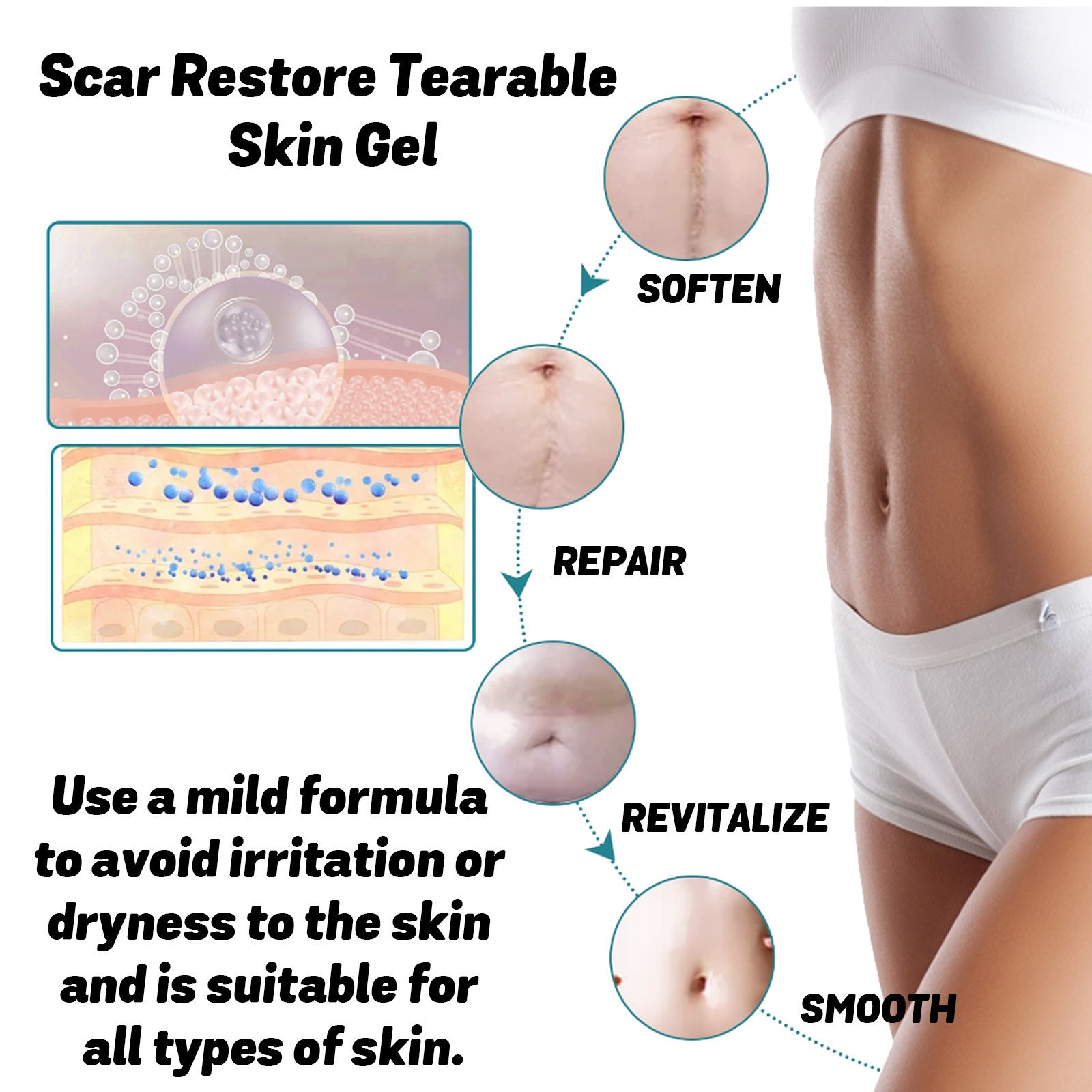 Skin Thinning Scar Care Gel